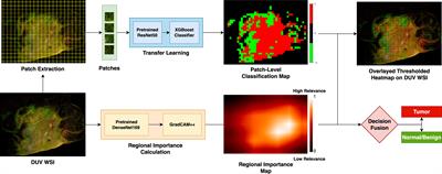 Deep learning classification of deep ultraviolet fluorescence images toward intra-operative margin assessment in breast cancer